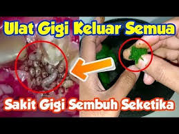 Ponstan sering digunakan untuk mengobati rasa sakit mulai dari sakit gigi sampai cedera otot bahkan sakit setelah melahirkan. Sakit Gigi Sembuh Seketika Sampai Ulat Gigi Keluar Semua Youtube Kesehatan Alternatif Kesehatan Gigi