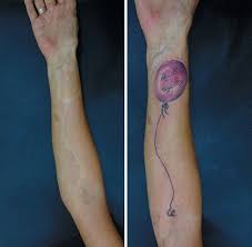 This area is specific with the fact that in most cases it is bold that's why it doesn't need shaving before a session. 211 Amazing Tattoos That Turn Scars Into Works Of Art Bored Panda