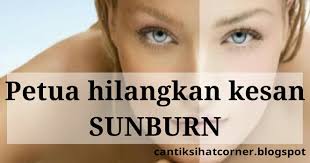 Sampai muka uzu pun penuh jerawat pasir 1 muka. Petua Menghilangkan Kesan Sunburn Agar Muka Tak Berbelang Lagi Cantik Sihat Corner