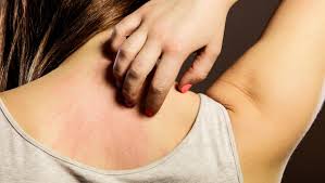 Emuaid.com has been visited by 100k+ users in the past month How Do I Get Rid Of A Recurring Scabies Infection Independent Ie