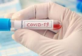 Wajib Rapid Test Antigen Sampai 8 Januari Padek Co
