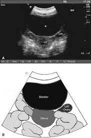 These exams are frequently used to evaluate the reproductive and urinary systems. Abdominal Pelvic Ultrasound Chapter 21 Clinical Emergency Radiology