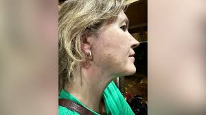 He just turned and shot the firework right at me': Waterloo councillor