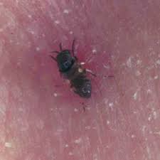 Fly to shannon and find yourself on the doorstep of ireland's wildest, most iconic beauty. Black Flies Simulium Slossonae Dyar Shannon On Grass Hanging In Download Scientific Diagram