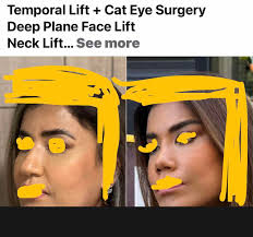 Best doctors in Tijuana for veneers?