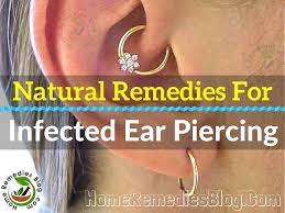 People Go With Current Trend And Body Piercing Is One Of Them Humans Have Evolved Over Infected Ear Piercing Cartilage Piercing Infection Ear Piercings Helix