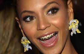 Why Do People Need Braces Celebrities With Braces Braces Colors Cute Braces