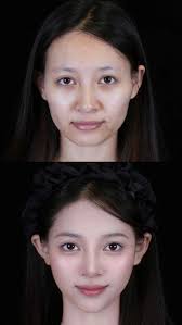 35+骨像抗衰幼态调整，普女微调果然妥妥靠的是美商, 从寡相变气质御姐～, 减龄的同时柔和面部轮廓，状态感十足, 拒绝寡相  从面部轮廓和T区口周开始，稳稳的, 垮脸怎么改善？法令纹深怎么办, 苹果肌提升，下颌缘提升，到底应该怎么提升？,  筋膜提升，法令纹如何改善，口周松弛，垮脸了应该怎么提升, #骨像幼态抗衰 #幼态审美 #美学设计 #马来西亚 #徐薈清  #解锁更多变美的理念让你变美省心又省力 ...