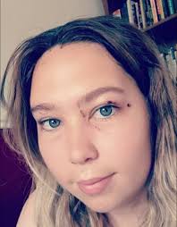 Cat scratch injury to the eye