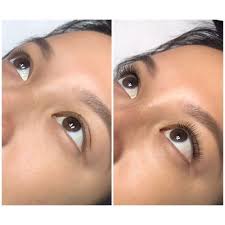 Skin Transformation, 1599 Superior Ave, Costa Mesa, CA 92627, US