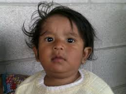 Edgar from Guatemala raised $525 for intensive nutritional therapy.