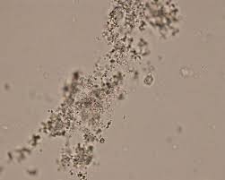 Pin On Urine Microscopy Notes
