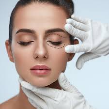Eyelid Surgery Minnetonka