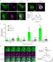 Explain the structure of stomata with a labelled diagram. Organelle Membrane Specific Chemical Labeling And Dynamic Imaging In Living Cells Nature Chemical Biology