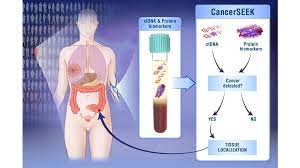 Computational biologist and cancer researcher jimmy lin is one of. Single Blood Test Screens For Eight Cancer Types