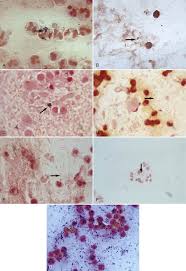 Image result for CSF Gram Stain
