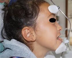 Upper Airway Expansion in Disabled Children