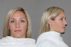 WINSTEAD HEATHER LYNN 01/15/2025