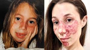 As we walked toward the doctor's office, the fear made my body cold. I  would feel my anxiety bubbling up, making it harder to breathe. I wanted to  pull away from my