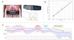 Safety and Feasibility of an Implanted Inferior Vena Cava Sensor for ...