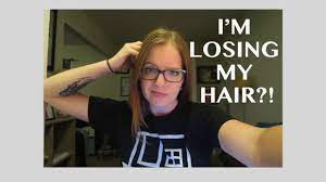 Hair loss by people taking wellbutrin (bupropion). Wellbutrin Hair Loss Corafromyoutube Corafromyoutube Youtube