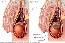 The type can help guide some of the treatment choices. Scrotal Masses Symptoms And Causes Mayo Clinic