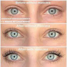 Stop Wasting Time Putting On Fake Lashes Why Because You Know They Look Fake People Search For All Sorts Of Methods To G Lash Boost Rodan And Fields Lashes