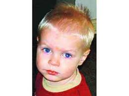 Tim mit blauen Flecken übersät