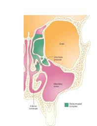 Sinusitis