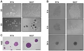 Maybe you would like to learn more about one of these? Impact Of Spheroid Culture On Molecular And Functional Characteristics Of Bladder Cancer Cell Lines