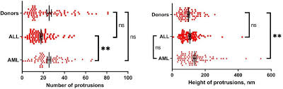 Check spelling or type a new query. Morphometric And Elastic Properties Of Immature Reticulocytes In Health And During Acute Lymphoblastic And Acute Myeloid Leukemia Biorxiv