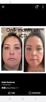 Grieving and missing a pet