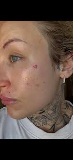 Can anyone recommend a good nickel-free eyelash curler please? I have been  using Kevin Aucoin but it is giving me dermatitis