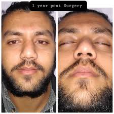 Dr Nain Bahadur Mahato