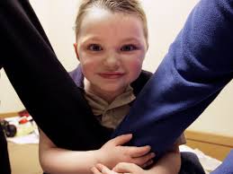 One in a billion: A baffling illness