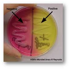 Mannitol Salt Agar Microbiology Microbiology Lab Medical Laboratory Scientist