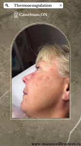 Consultation gratuite , PM moi !!!