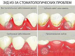 Maybe you would like to learn more about one of these? Cheshutsya Desna Chto Delat Kiev Lyumident