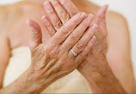Check spelling or type a new query. How To Make Your Hands Look Younger Health Essentials From Cleveland Clinic