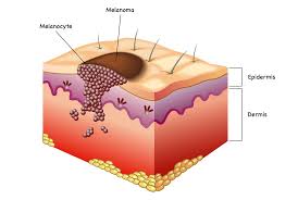 Image result for Melanocyte