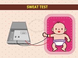 Image result for Sweat Chloride