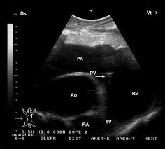 Lots of people with warm hearts! Echocardiography Of The Normal Camel Camelus Dromedaries Heart Technique And Cardiac Dimensions Bmc Veterinary Research Full Text