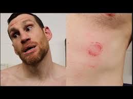 RESULTS: David Price Wins Wild Fight With Kash Ali As Ali Is Disqualified  For Biting!