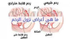علاج نزول الرحم كيفيه الوقايه من نزول الرحم صور حزينه