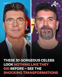 Photos of the stars who look TOTALLY DIFFERENT after DRASTIC CHANGES to  their faces.⬇️