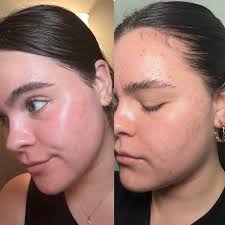 Profile for Genesis Glow Skincare Studio