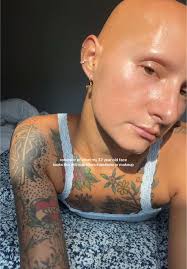 Aging Naturally: Embracing Authentic Beauty at 32