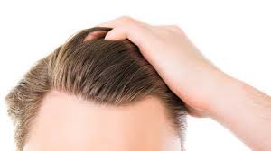 Sac Ekimi Nedir Istanbul Hair Clinic