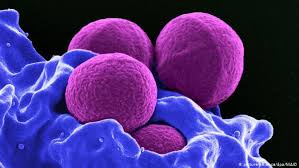 Die viren sind für menschen ungefährlich, aber bei vielen bakteriellen infektionen effektiv. Was Man Uber Super Keime Wissen Sollte Wissen Umwelt Dw 31 07 2019