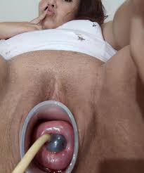 The best gape you will see extreme cervix 🔥 | Scrolller